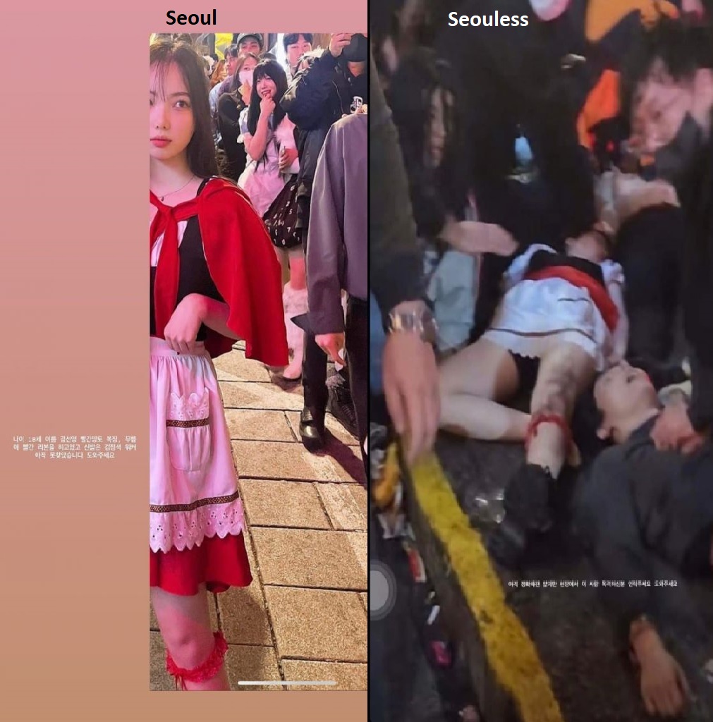 【画像】圧死した韓国人女性、痣がすごい・・・